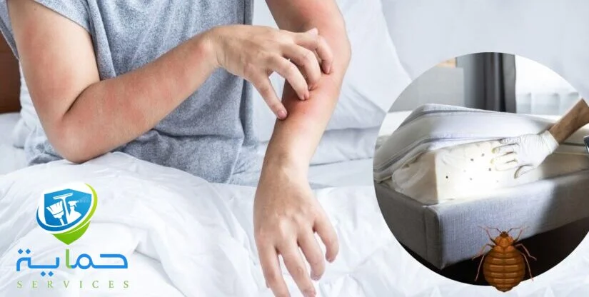 شركة مكافحة البق في خورفكان